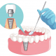 Dental Implants madison ms