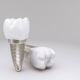 Root Canals delray beach fl